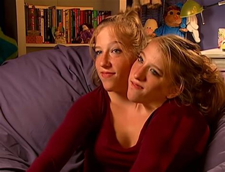 Abby And Brittany Hensel: Exploring Their Untimely Demise