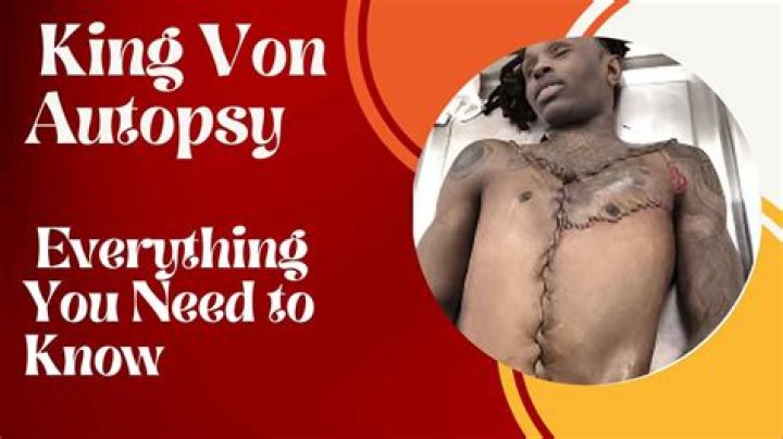 King Von's Autopsy Report: A Detailed Analysis